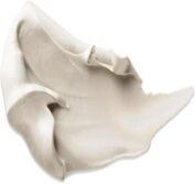کرم پوست مستعد آکنه هیسه‌اک اوریاژ 15g