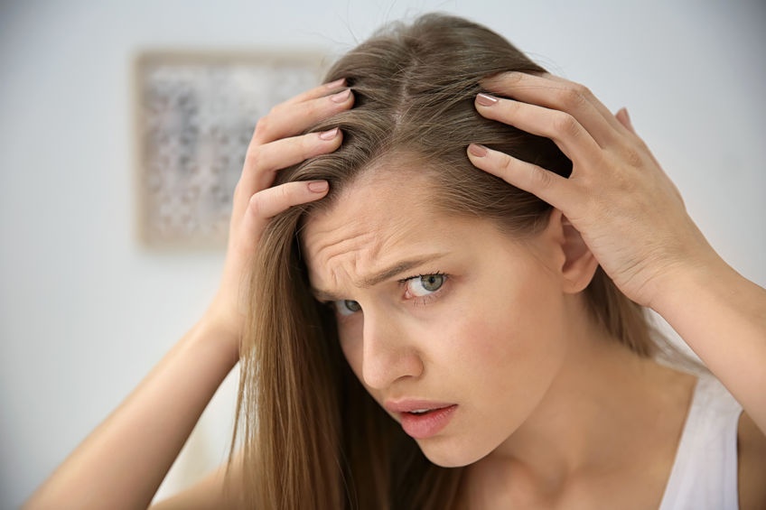 علل ریزش موی سر هورمونی در زنان