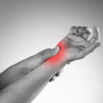 تنگی کانال مچ دست (سندرم تونل کارپال؛CTS) چیست و راه درمان آن