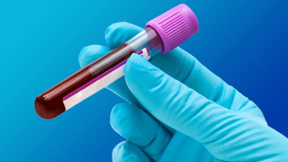 آیا تست خونی آزمایش بتا همیشه دقیق می باشد؟