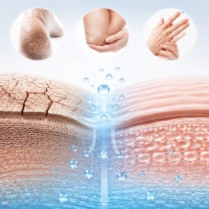 کرم مرطوب کننده قوی اوره 20 درصد دکتر ژیلا 75 گرم