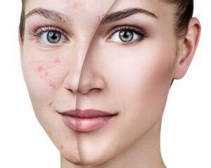 ژل شستشو و آبرسان 2 پوست خشک و حساس مورینگاامو 400 میلی لیتر